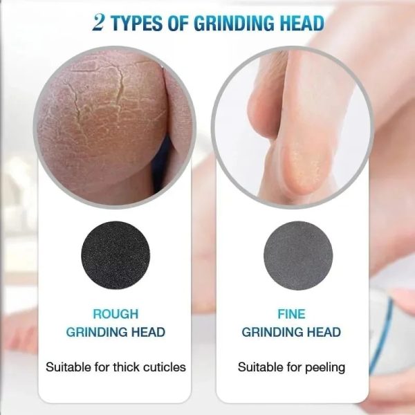 Back Callus Remover With Built-in Vacuum